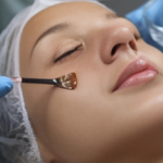 ACHIEVE GLOWING SKIN WITH CUSTOMIZED CLINICAL PEELS
